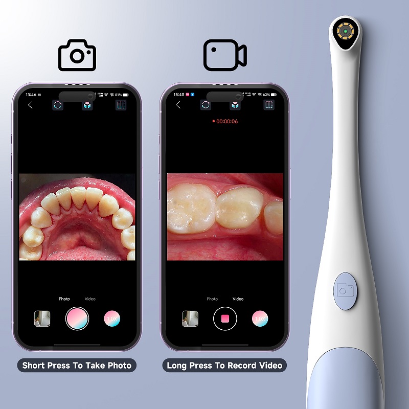 TYPE-C Visual Oral Camera for  - огляд і ціна Endoscope Inspection Camera