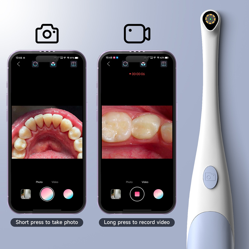 2 in 1 Oral Camera for Type-C/ - огляд і ціна Endoscope Inspection Camera